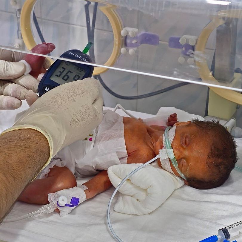 Ein Baby liegt im Inkubator Ein Baby liegt im Inkubator.